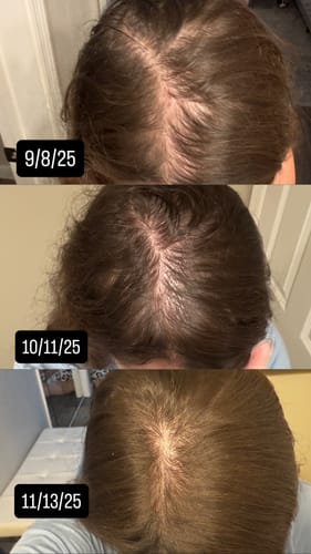 Customer photo review of VITAFOAM ™ Hair Growth Formula