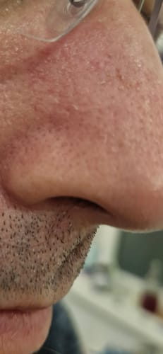 Customer photo review of Seb Natural Calming Serum