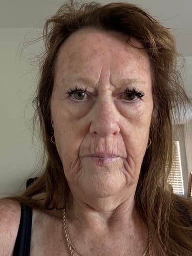 Customer photo review of Grass Fed Tallow & Honey Balm