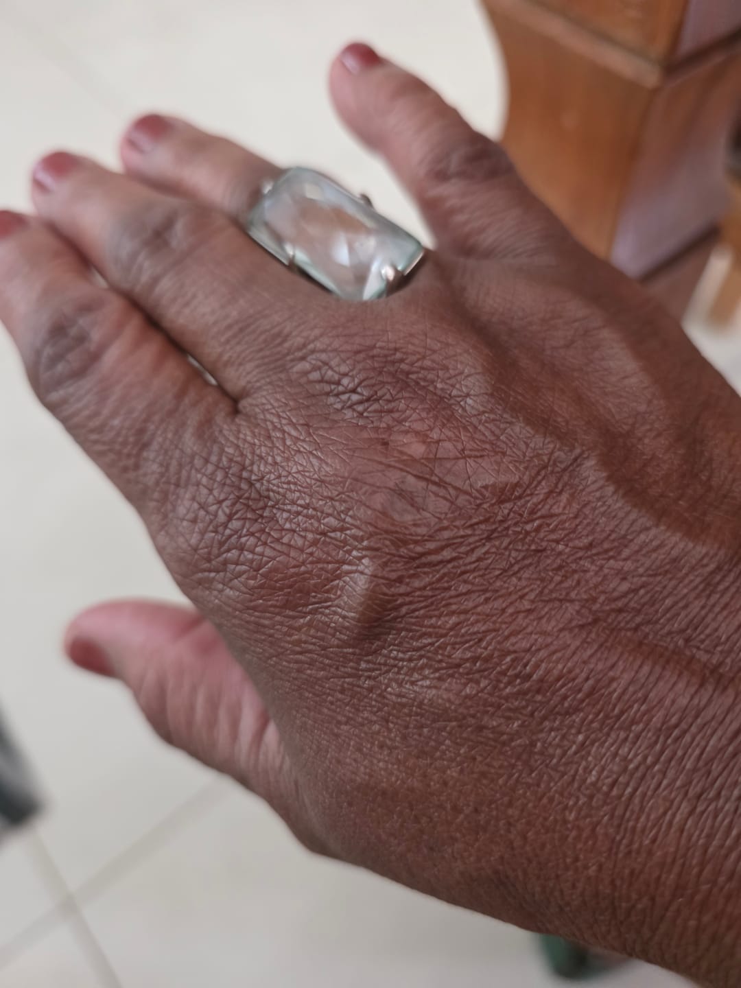 Customer photo review of Creme Hidratante Mãos Pró-Idade