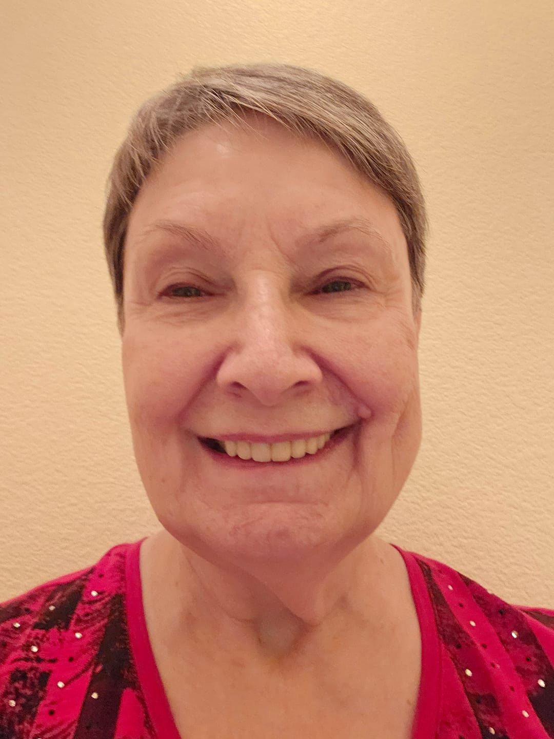 Customer photo review of F3 - DEEP HYDRATING AND PLUMPING SERUM