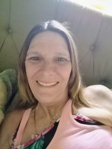 Customer photo review of Vega Bright Forest Green Prescription Colored Contact Lenses