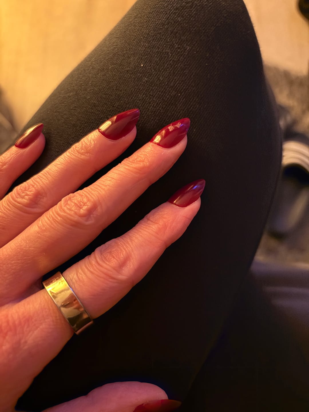Customer photo review of Starter Set - Nail Veneers