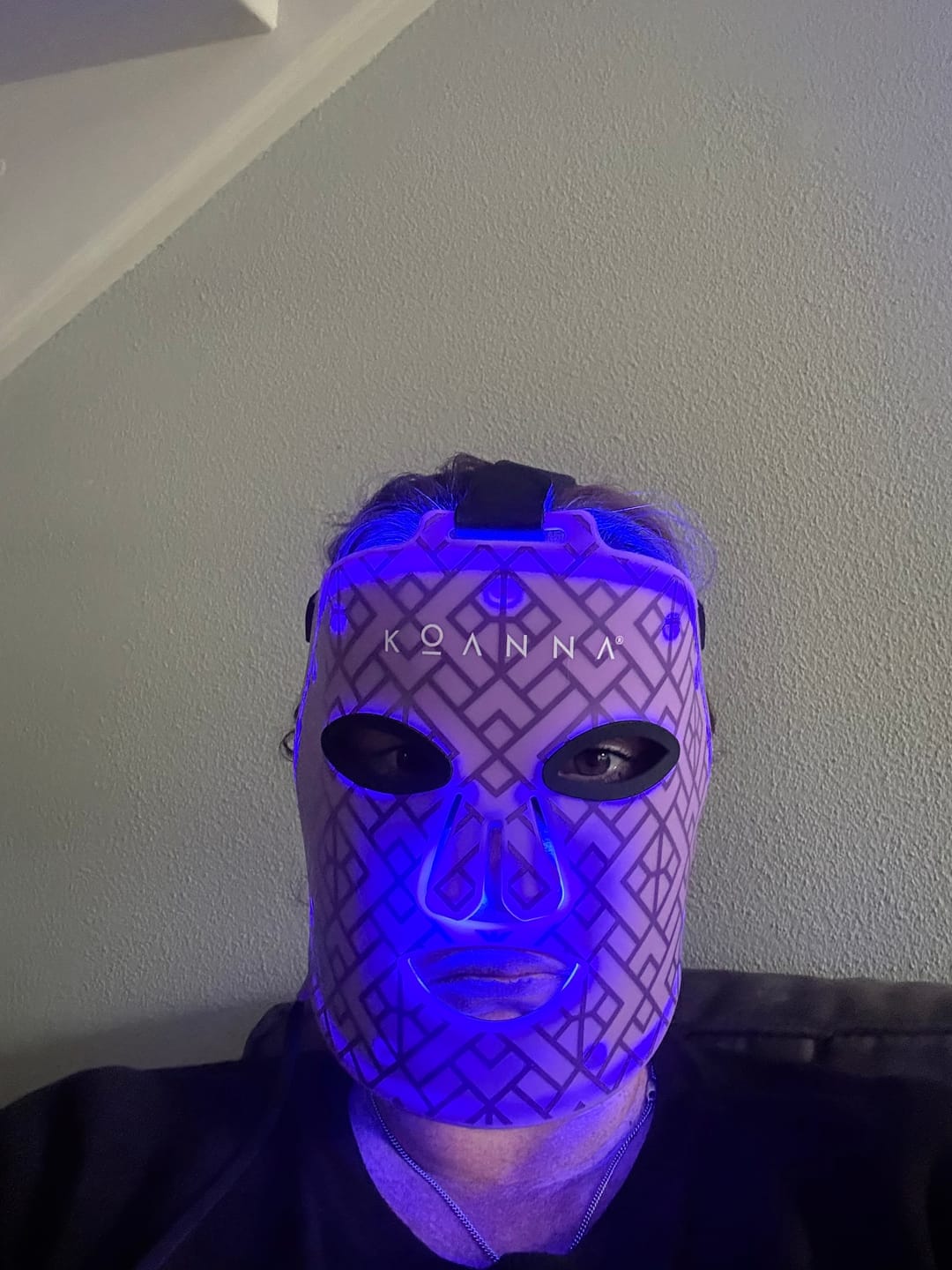 Customer photo review of Koanna® MultiGlo™ LED Lichttherapie-Maske
