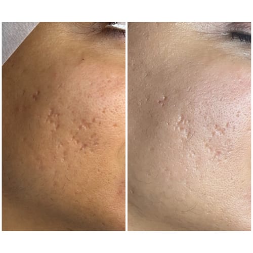 Customer photo review of Future Advanced Firming Mask