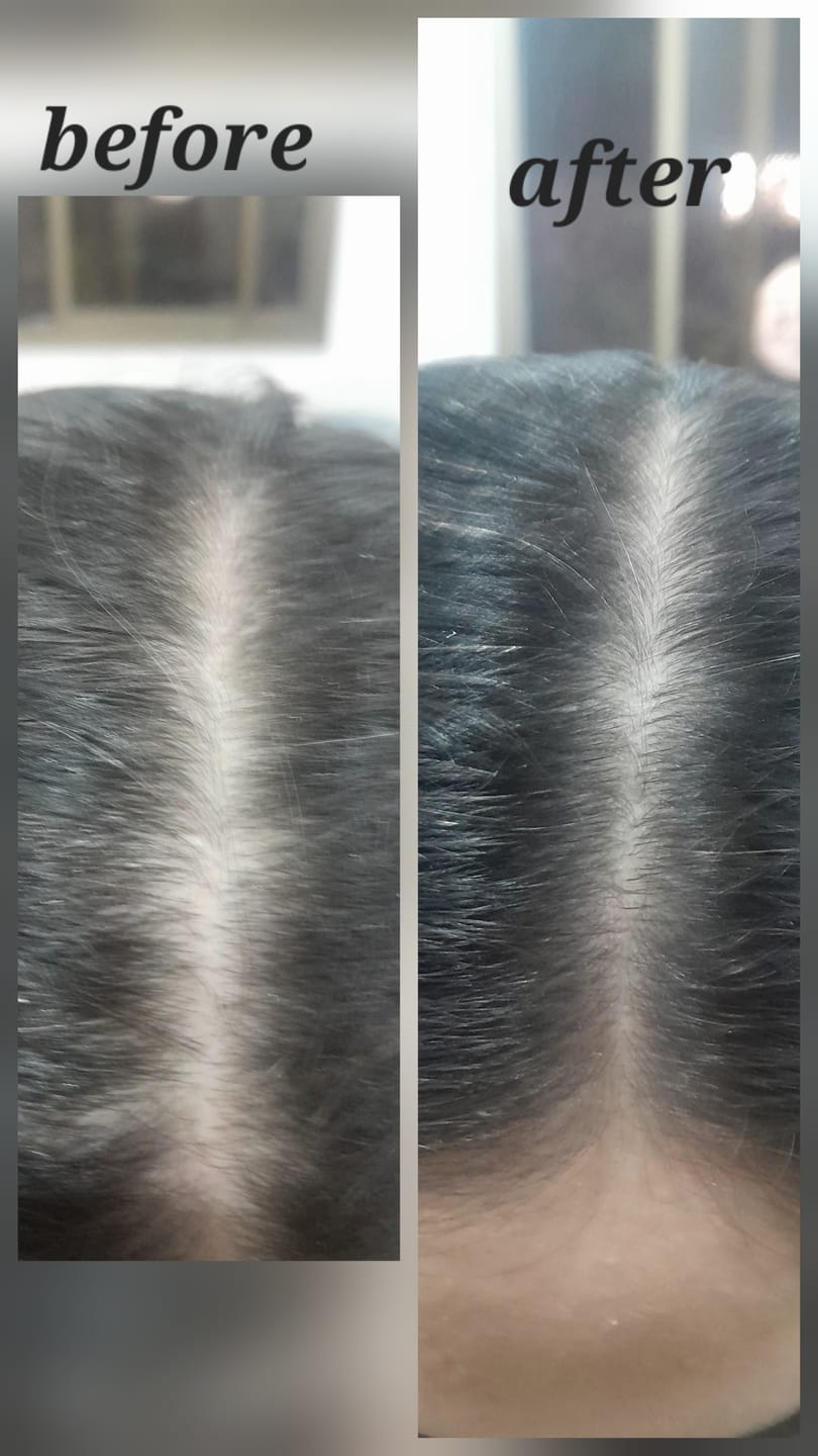 Customer photo review of 32 Day Hair Growth Challenge Bundle