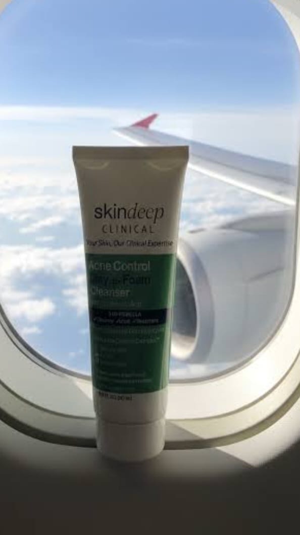 Customer photo review of Acne Control Clay-to-Foam Cleanser