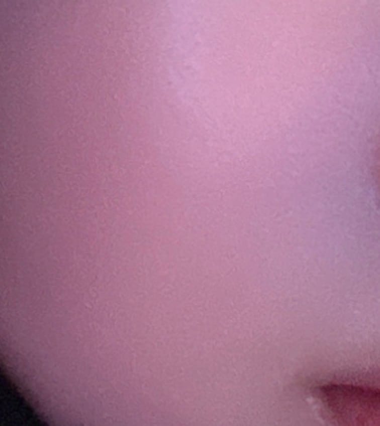 Customer photo review of テラスキン