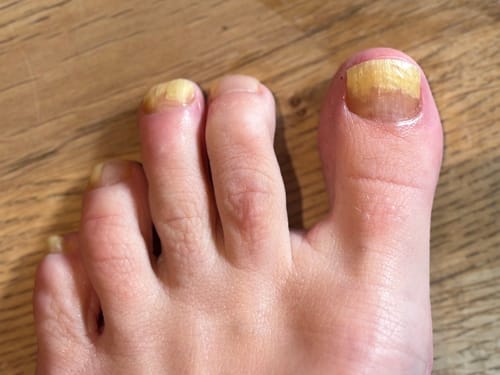 Customer photo review of Fungal Freedom