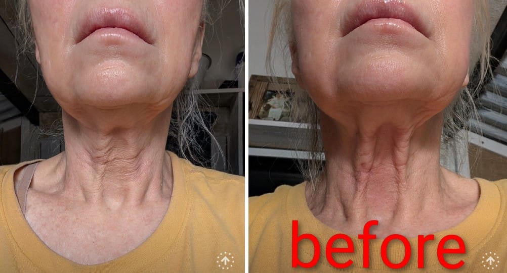 Customer photo review of VEAUTY Dot & Aqualis Activator