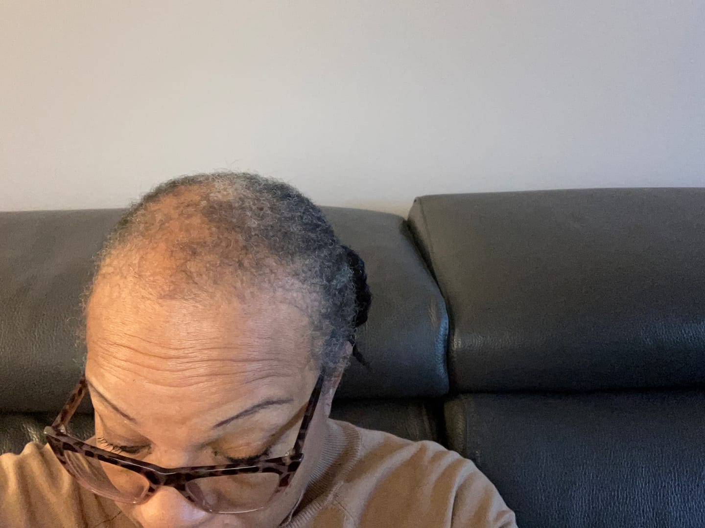 Customer photo review of 100% NATURAL HAIR GROWTH OIL - 2oz / 58ml