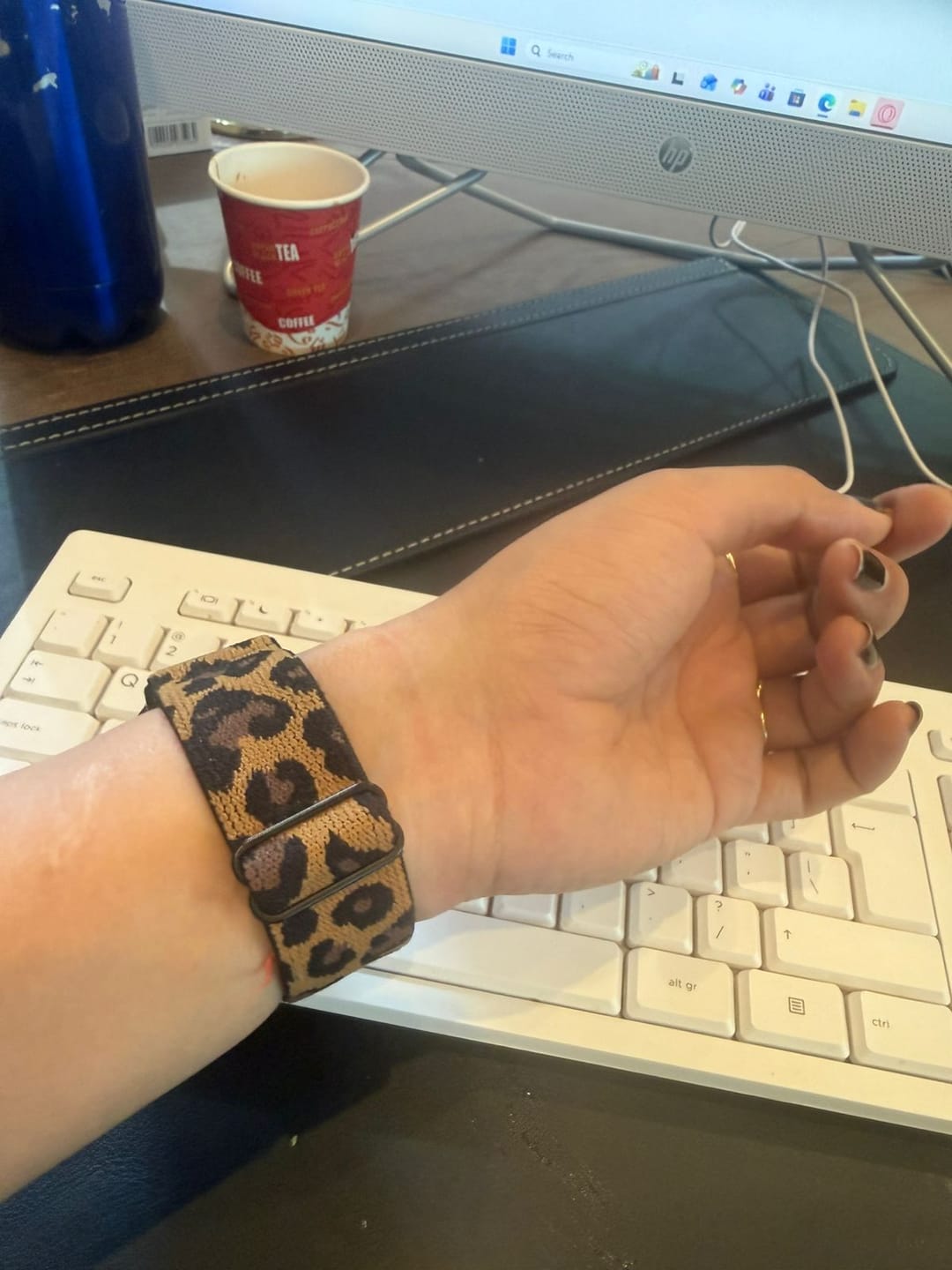 Customer photo review of Roxane Nylon Loop Band