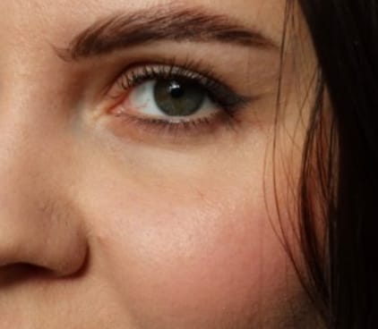 Customer photo review of Toplash eyelash and eyebrow growth serum — 3ml