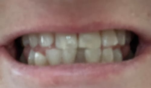 Customer photo review of NEW: Mint Floss