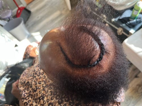 Customer photo review of Rennora Hair Growth Serum