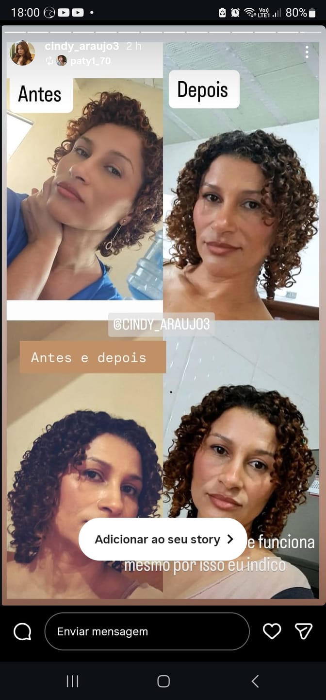 Customer photo review of Happy Hair 6 Potes + 6 Potes Grátis + 1 Melatonina + 1 Colágeno + 1 Happy Calm (Total 15 Potes)