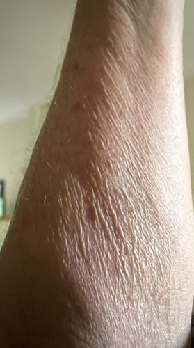 Customer photo review of Besque™ Magic Body Oil - Unscented