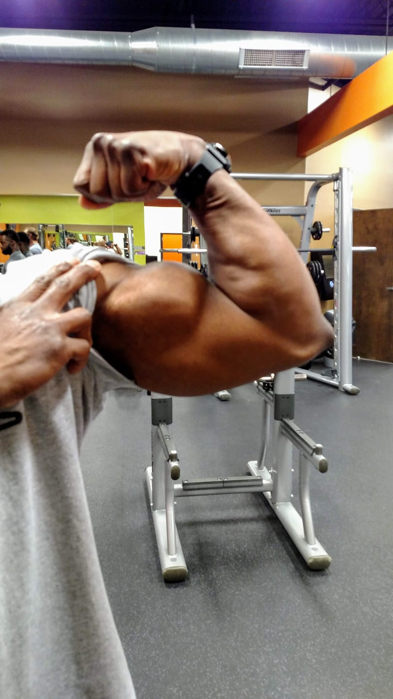 Customer photo review of Prostate Support