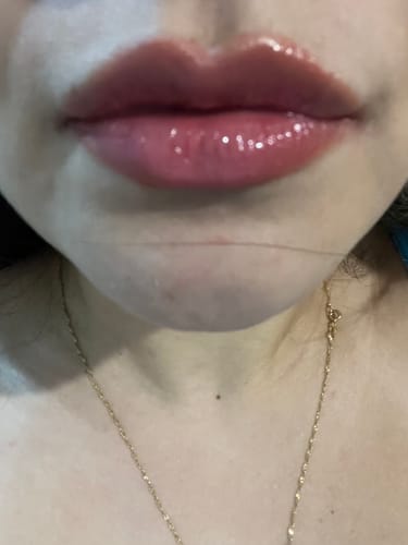 Customer photo review of PEPTIDE LIP BALM