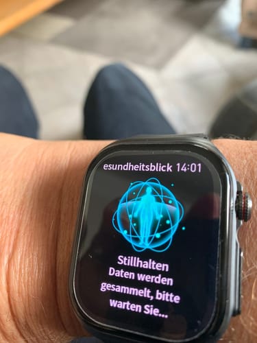 Customer photo review of Orthowatch Arca