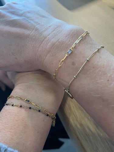 Customer photo review of Permanent Armband - dein everbond in München