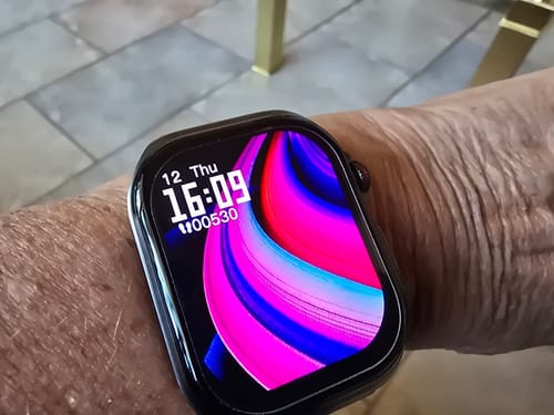 Customer photo review of Orthowatch Arca