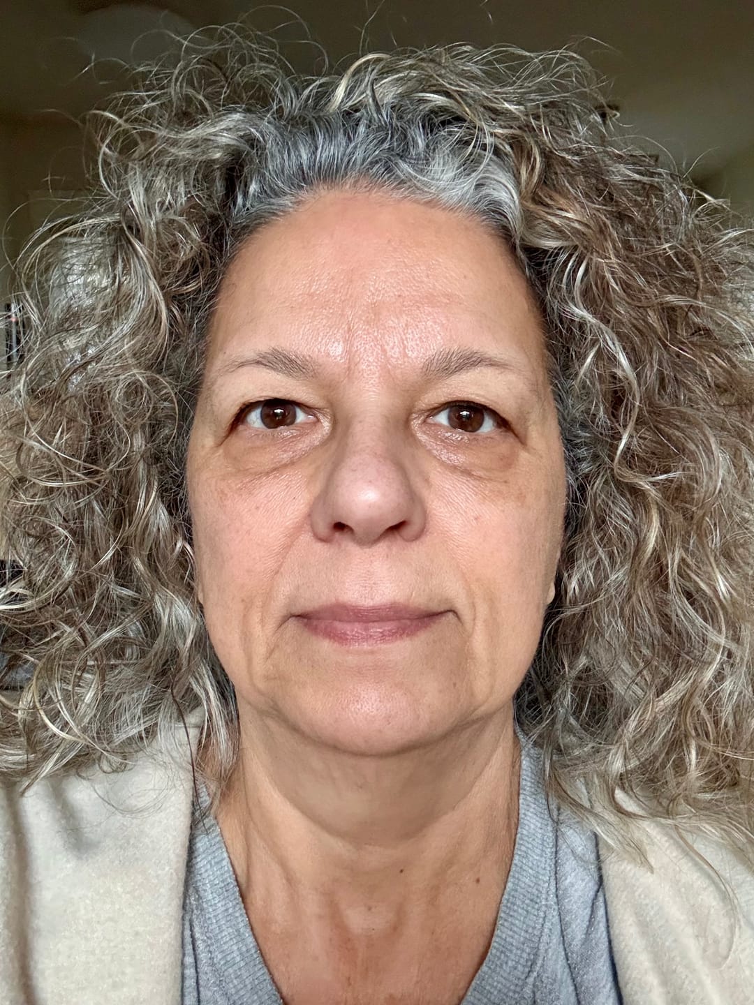 Customer photo review of The Complete System for Mature Women’s Skin
