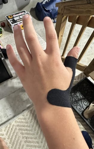 Kundenbewertung mit Foto zu TAPEX™ - Daumen