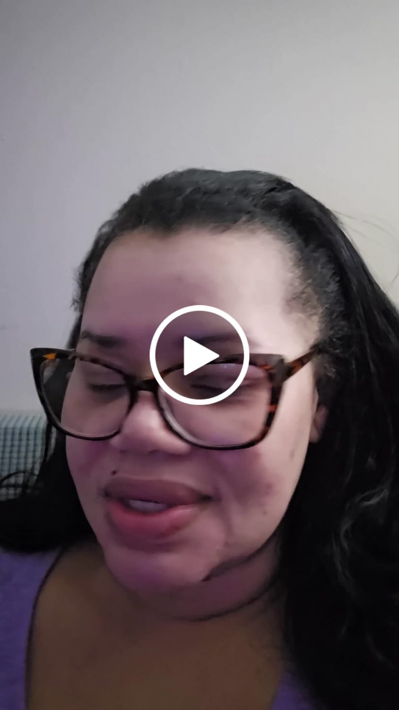 Customer video review of BIGGER EDITION: Jolie’s Full Body & Face Brightening / Acne Kit