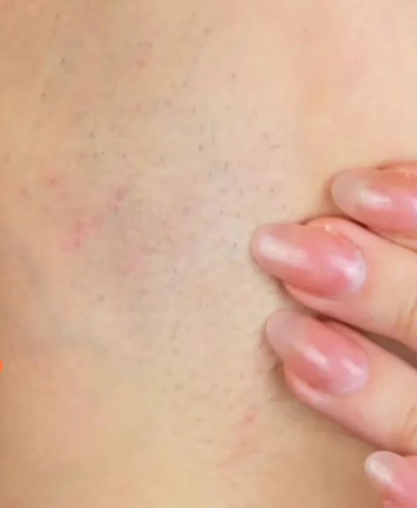 Customer photo review of Herbst Premium Haarfrei Bundle