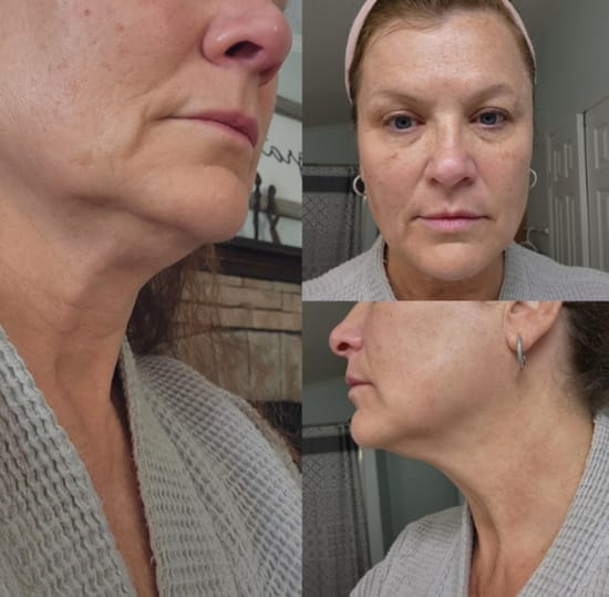 Customer photo review of LumiSkin Brush – Pour un visage défatigué et sculpté en quelques minutes