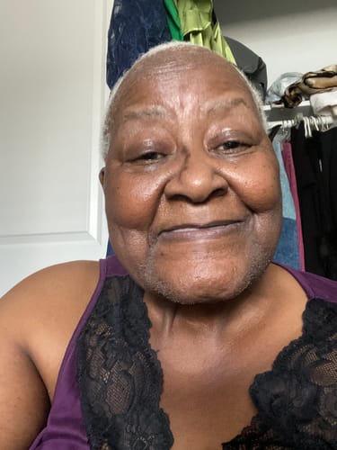 Customer photo review of Four Bottles of Rennora Hair Growth Serum