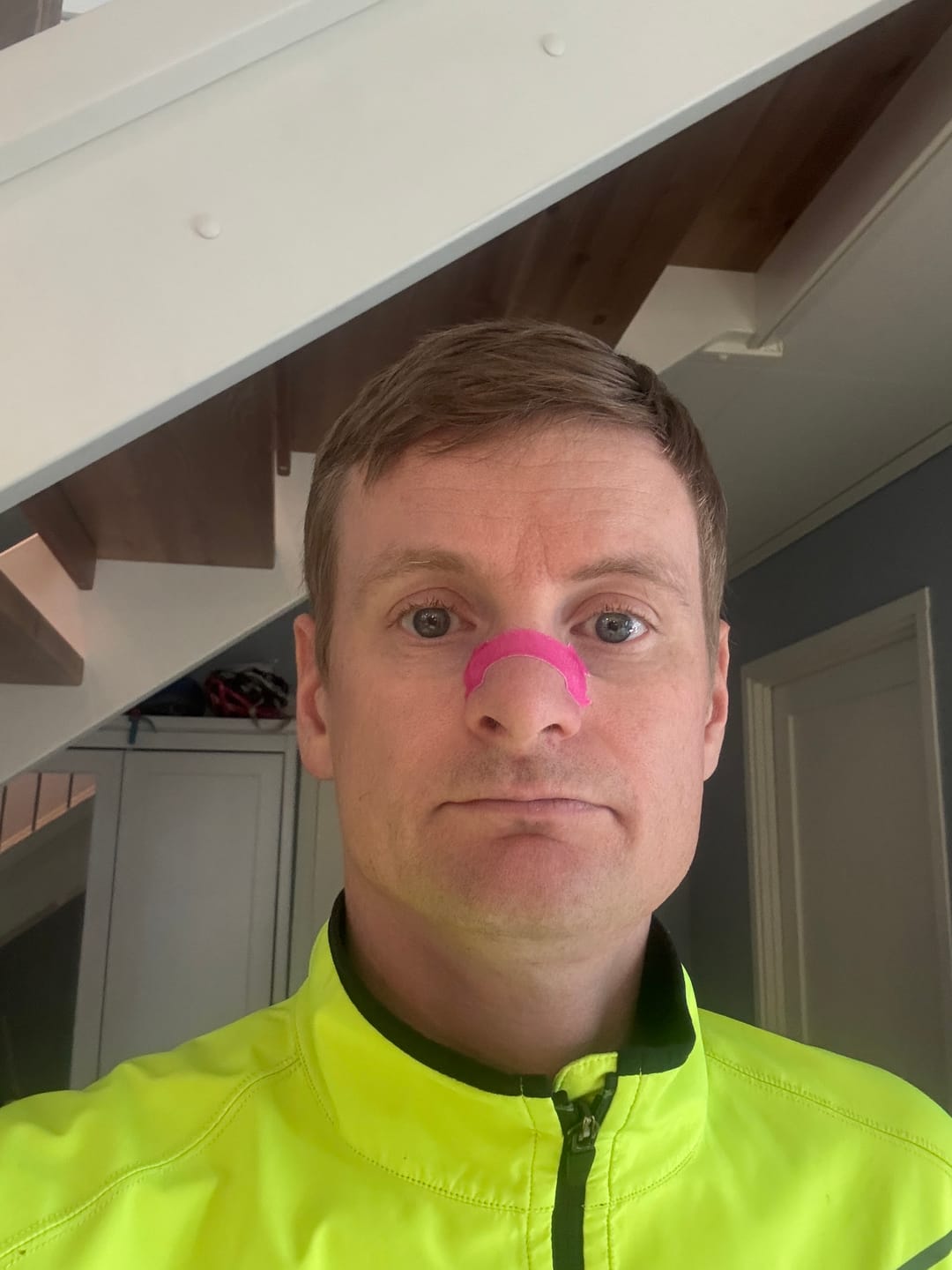 Customer photo review of NASAL STRIPS | PINK