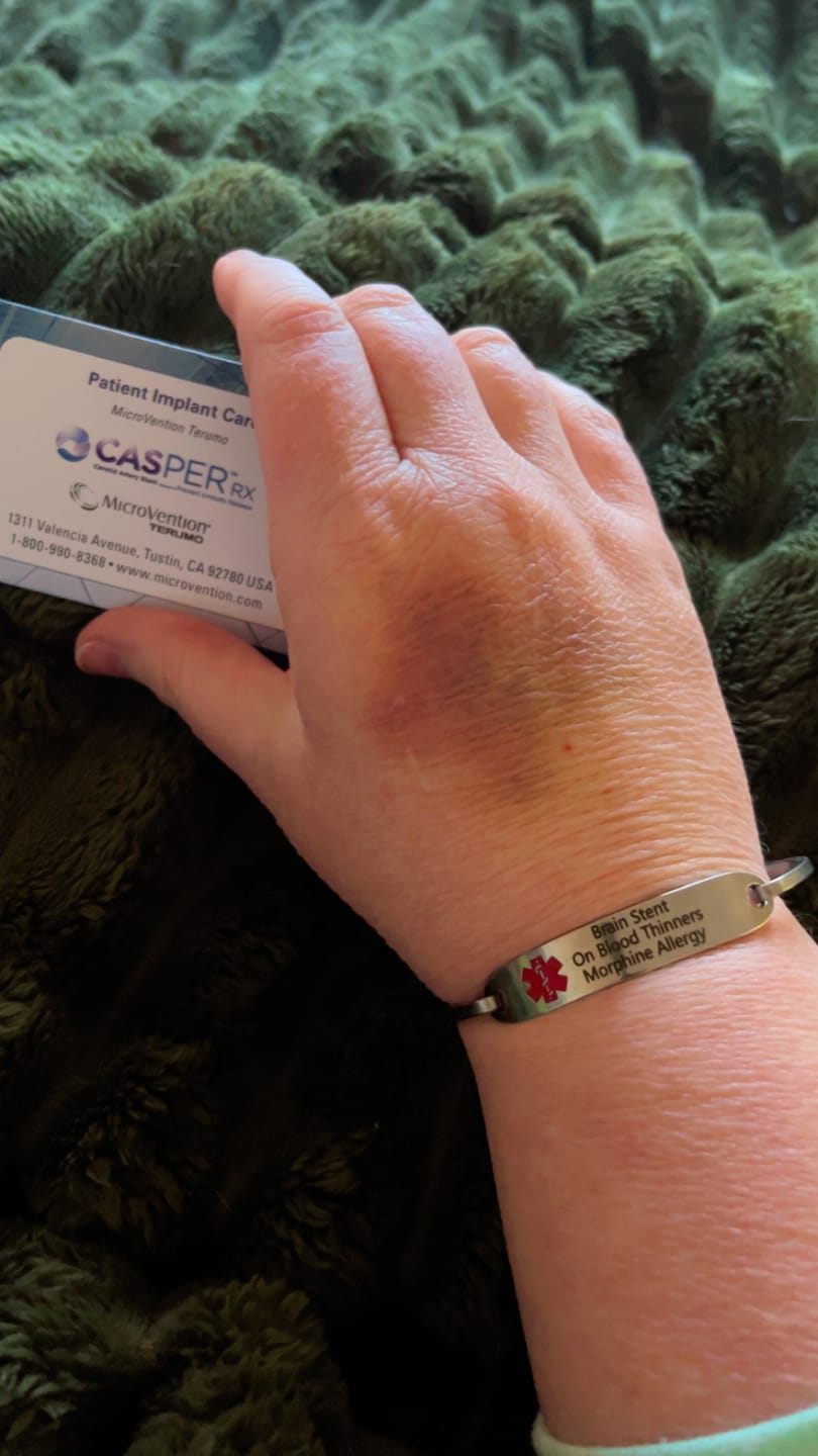 Customer photo review of Personalised Silver Medical Alert ID Bangle Bracelet