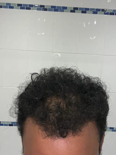 Customer photo review of Seb Natural Calming Serum