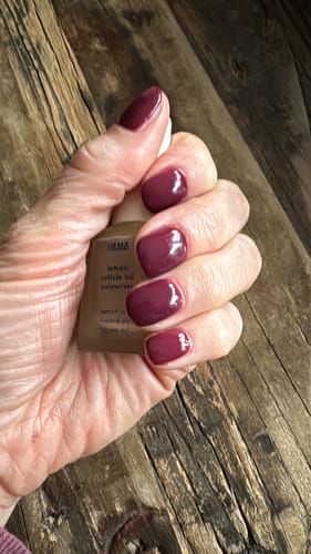 Customer photo review of Verzending Verzekering