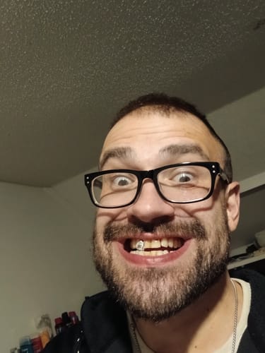 Customer photo review of Single Tooth Cap Bling Border Grillz