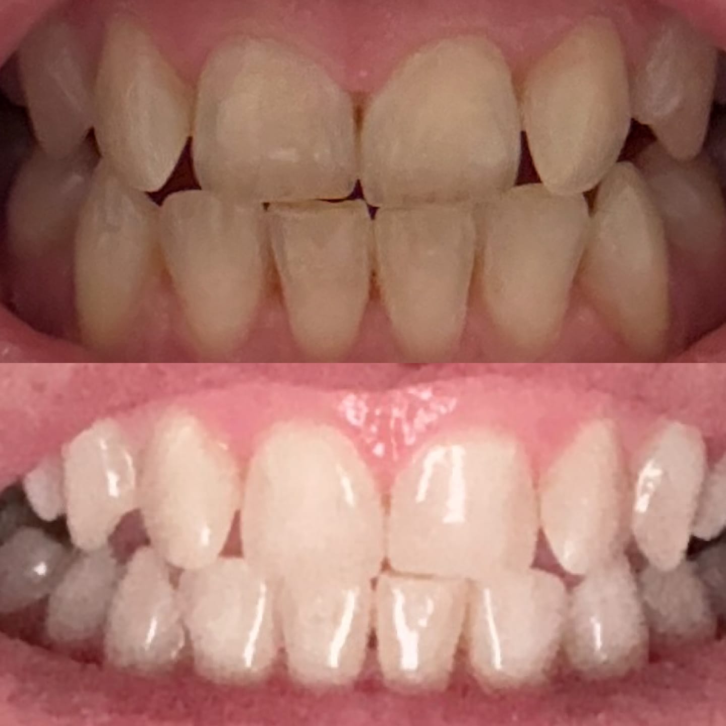 Customer photo review of Oral Care Essentials Bundle