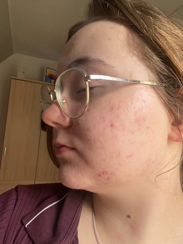 Customer photo review of Fade It! - Creme