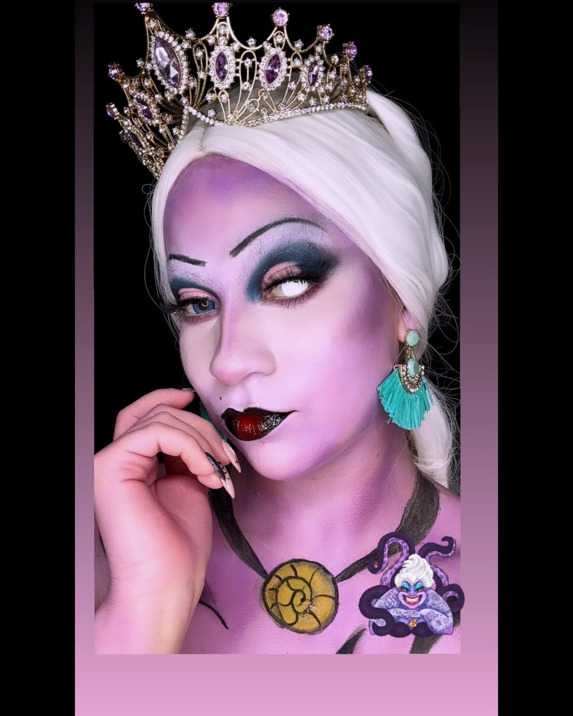 Customer photo review of Halloween White out Colored Contact Lenses