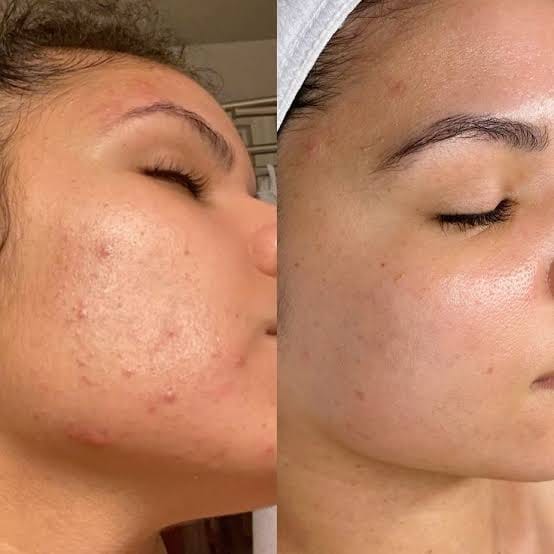 Customer photo review of Cerulic Glow Boosting Serum