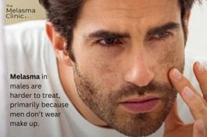 Customer photo review of Melblok Pigmentation Control Day Cream SPF 50+ PA++++