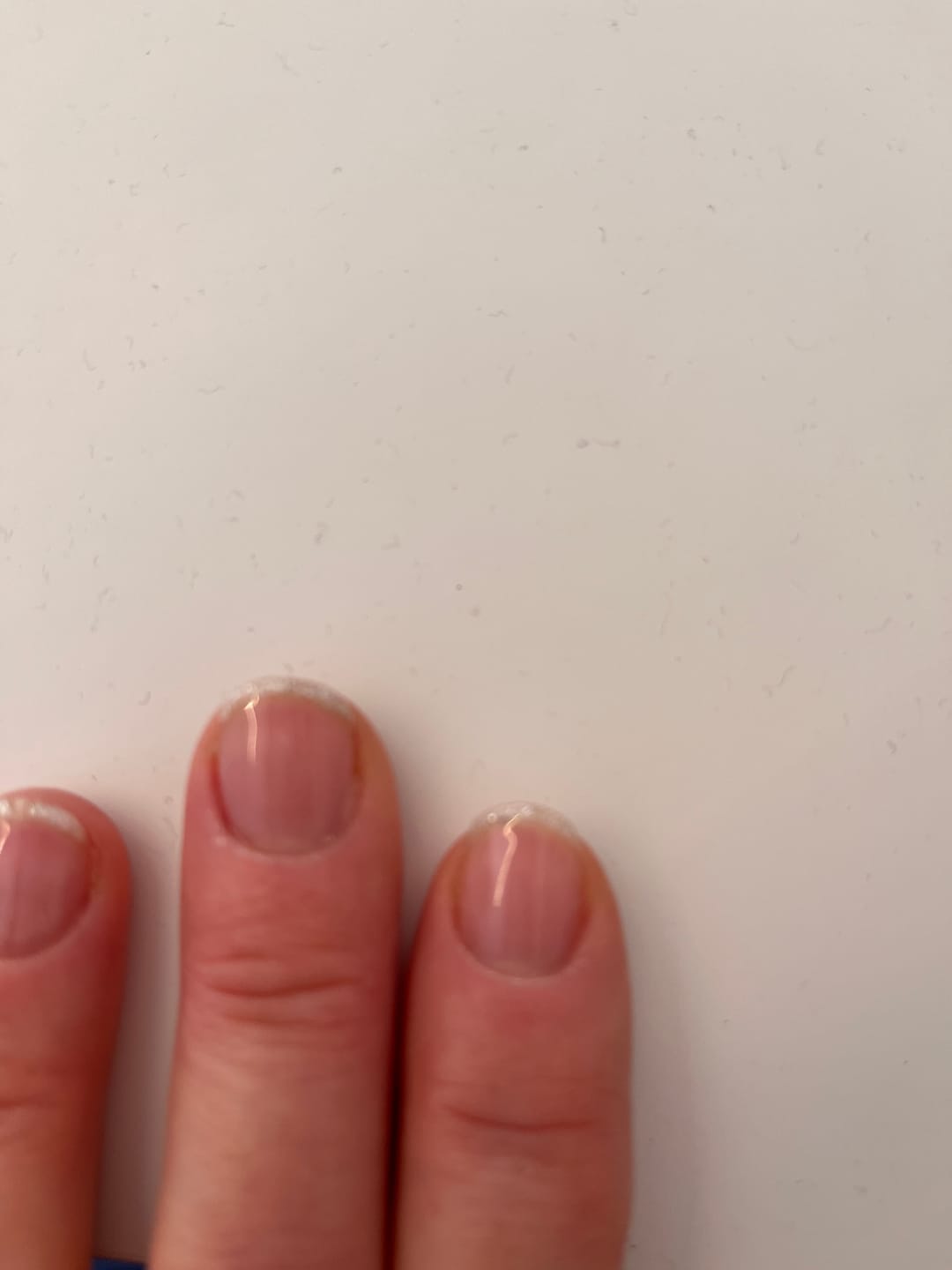 Customer photo review of LCI Combo Pack: Base Coat DryFix 10 ml + Top Coat DryFix 10 ml