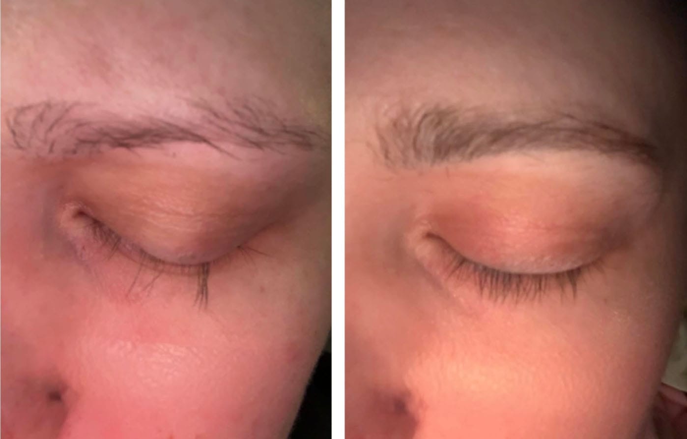 Customer photo review of LashGrow Serum
