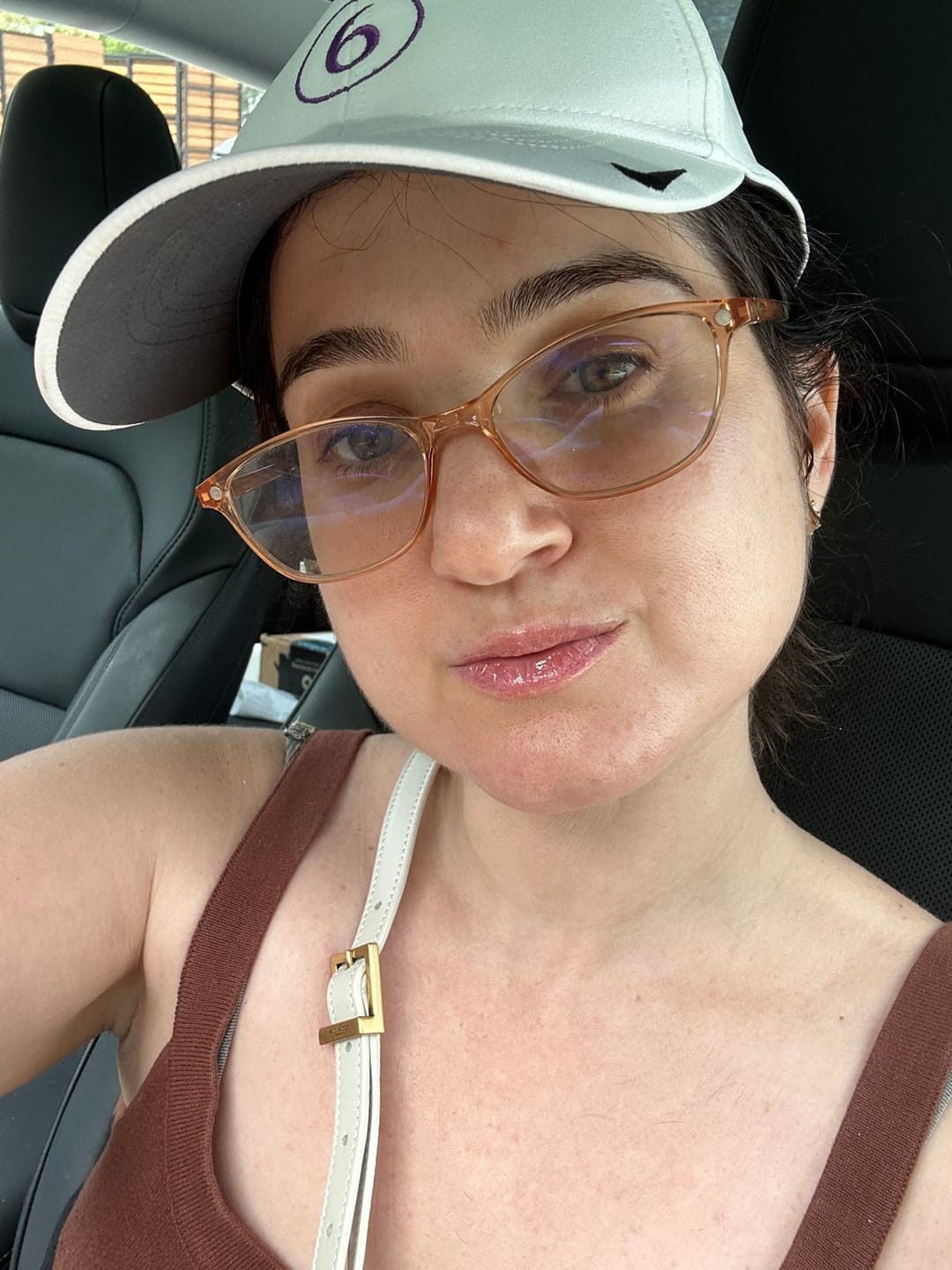 Customer photo review of Acne Formula