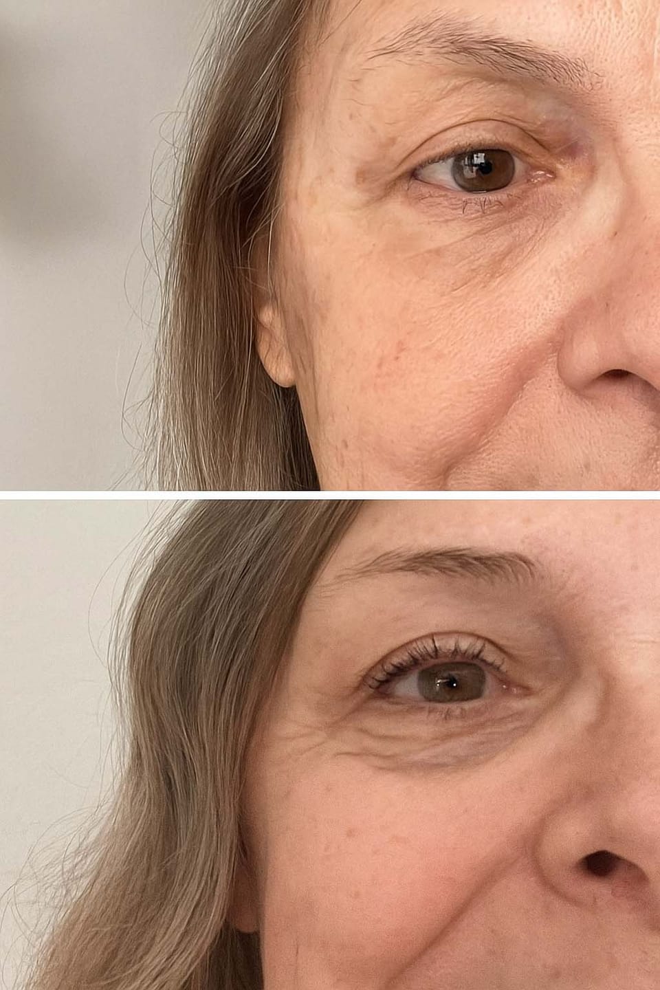 Customer photo review of LashGrow Serum