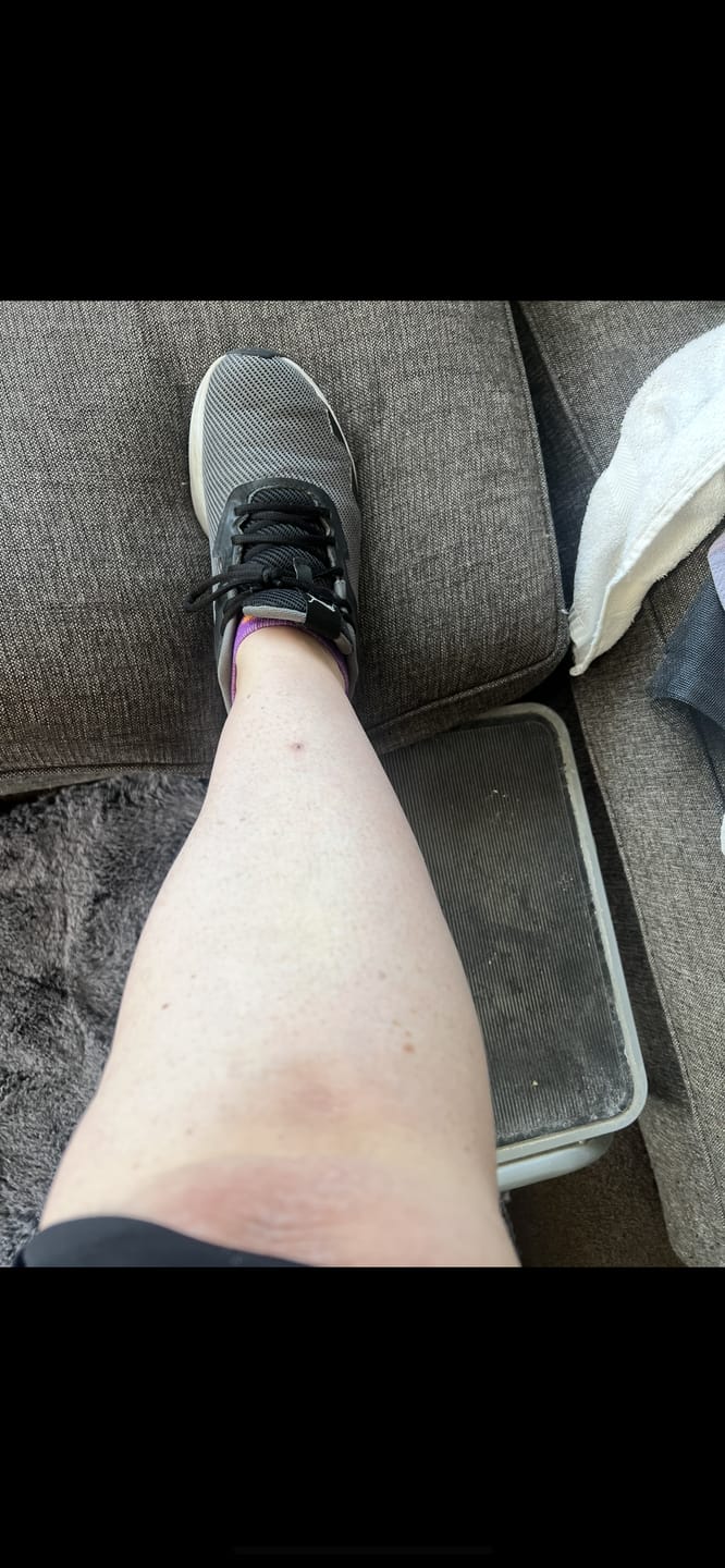 Customer photo review of Self Tanning 150 Capsules