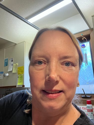 Customer photo review of Grass Fed Tallow & Honey Balm