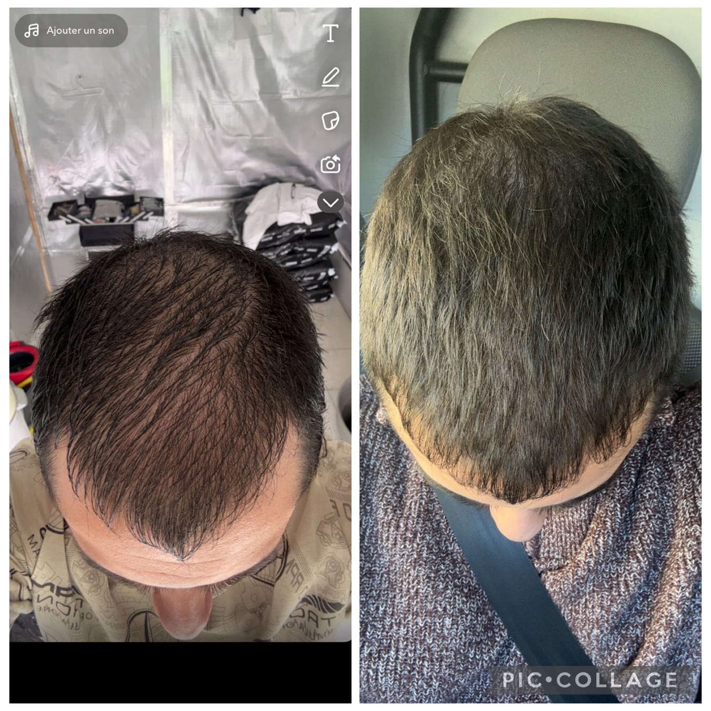 Customer photo review of La potion magique - Hair transformation