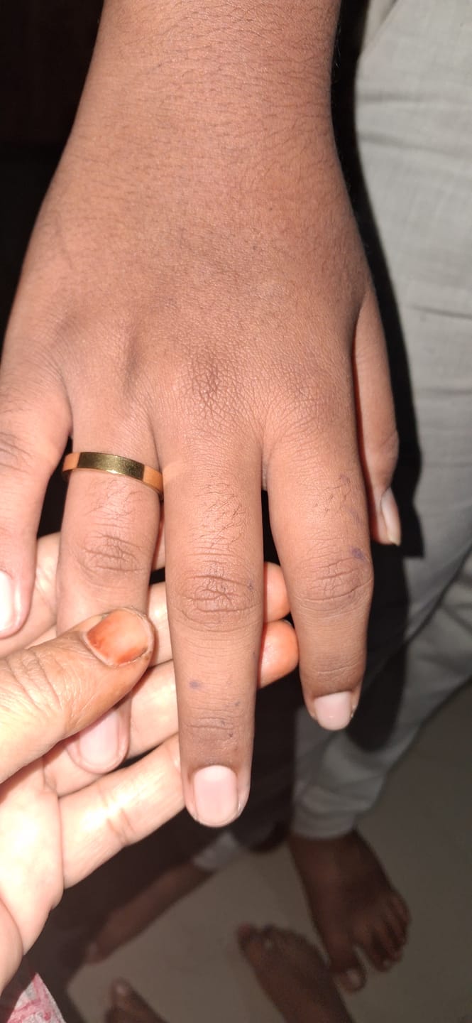 Customer photo review of Vintage Gold Band Ring